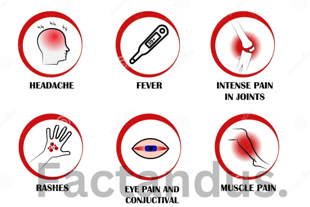 West Nile virus